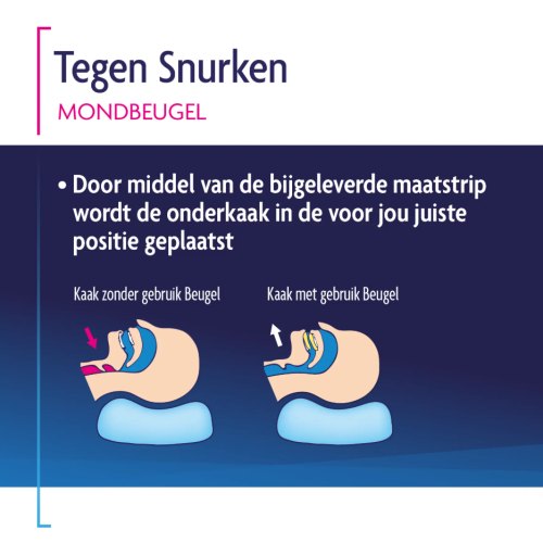 Shiepz Tegen Snurken Mondbeugel 1 stuk