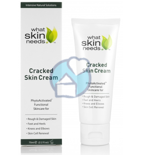 What Skin Needs Cracked Skin Cream